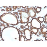 Immunohistochemistry - Anti-Thyroid Peroxidase Antibody [TPO/3694] (A250201) - Antibodies.com