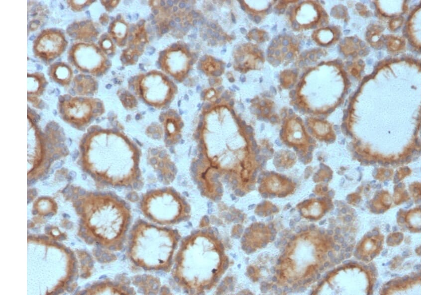 Immunohistochemistry - Anti-Thyroid Peroxidase Antibody [TPO/3695] (A250202) - Antibodies.com