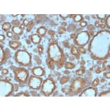 Immunohistochemistry - Anti-Thyroid Peroxidase Antibody [TPO/3695] (A250202) - Antibodies.com