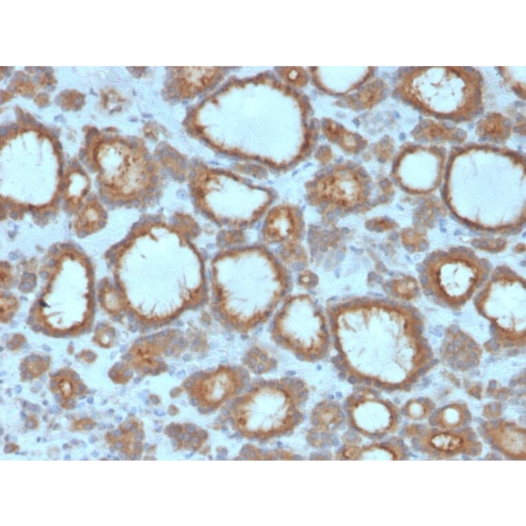 Immunohistochemistry - Anti-Thyroid Peroxidase Antibody [TPO/3695] (A250202) - Antibodies.com