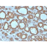 Immunohistochemistry - Anti-Thyroid Peroxidase Antibody [TPO/3695] (A250202) - Antibodies.com