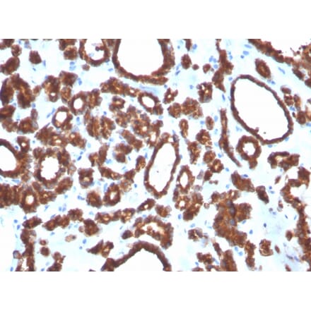 Immunohistochemistry - Anti-Thyroid Peroxidase Antibody [TPO/3697] (A250203) - Antibodies.com