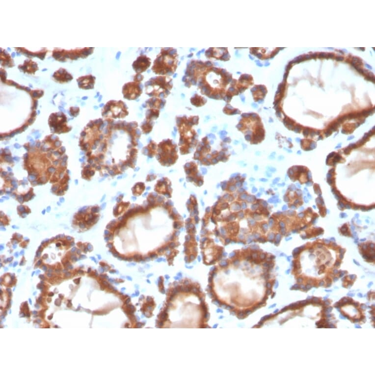 Immunohistochemistry - Anti-Thyroid Peroxidase Antibody [TPO/3697] (A250203) - Antibodies.com