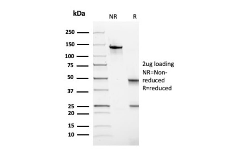 SDS-PAGE - Anti-Thyroid Peroxidase Antibody [TPO/3697] (A250203) - Antibodies.com