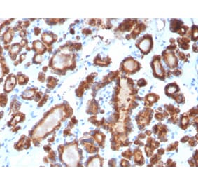 Immunohistochemistry - Anti-Thyroid Peroxidase Antibody [TPO/3698] (A250204) - Antibodies.com