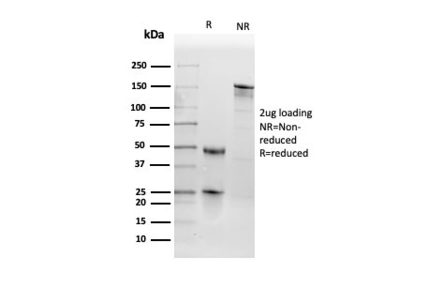 SDS-PAGE - Anti-Thyroid Peroxidase Antibody [TPO/3698] (A250204) - Antibodies.com