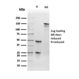 SDS-PAGE - Anti-Thyroid Peroxidase Antibody [TPO/3698] (A250204) - Antibodies.com