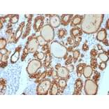 Immunohistochemistry - Anti-Thyroid Peroxidase Antibody [TPO/3813R] (A250204) - Antibodies.com