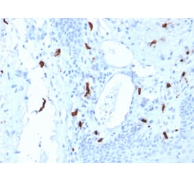 Immunohistochemistry - Anti-Mast Cell Tryptase Antibody [TPSAB1/1961] (A250206) - Antibodies.com