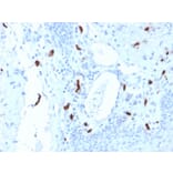 Immunohistochemistry - Anti-Mast Cell Tryptase Antibody [TPSAB1/1961] (A250206) - Antibodies.com