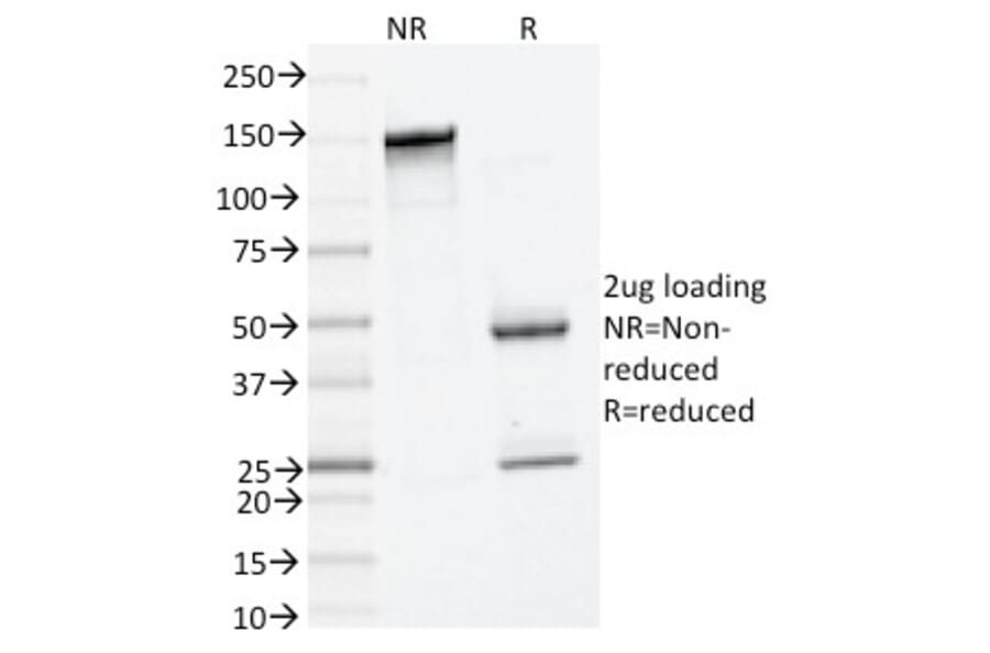 SDS-PAGE - Anti-Mast Cell Tryptase Antibody [TPSAB1/1961] (A250206) - Antibodies.com
