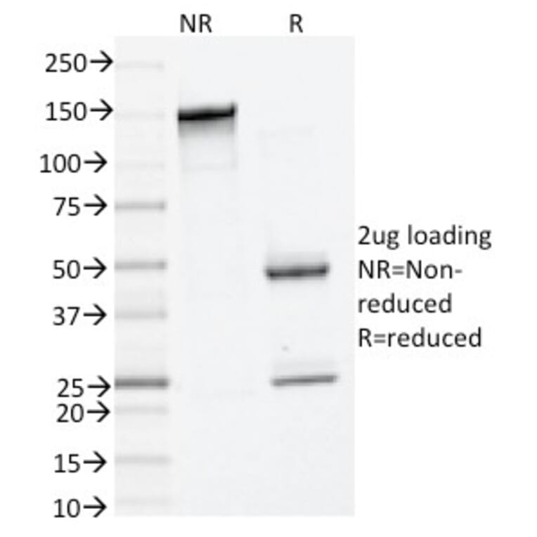SDS-PAGE - Anti-Mast Cell Tryptase Antibody [TPSAB1/1961] (A250206) - Antibodies.com