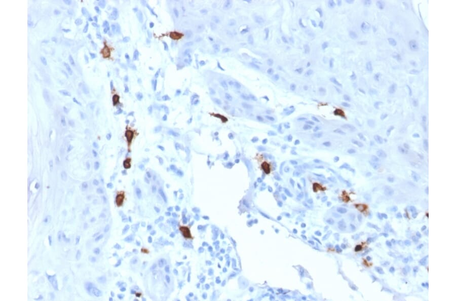 Immunohistochemistry - Anti-Mast Cell Tryptase Antibody [TPSAB1/1963] (A250206) - Antibodies.com