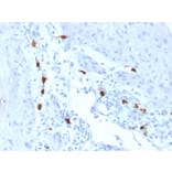 Immunohistochemistry - Anti-Mast Cell Tryptase Antibody [TPSAB1/1963] (A250206) - Antibodies.com