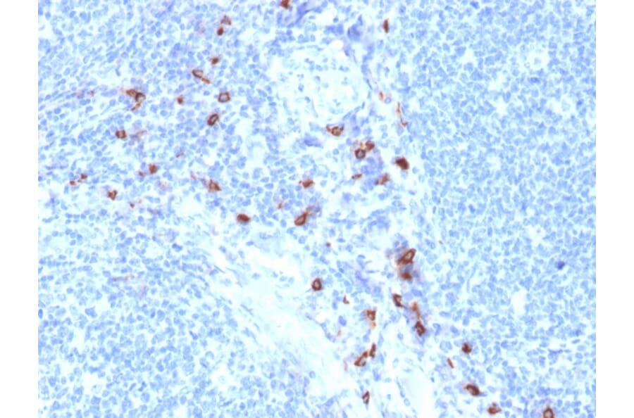 IHC - Anti-Mast Cell Tryptase Antibody [TPSAB1/1963] (A250207)
