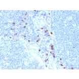 Immunohistochemistry - Anti-Mast Cell Tryptase Antibody [TPSAB1/1963] (A250207) - Antibodies.com
