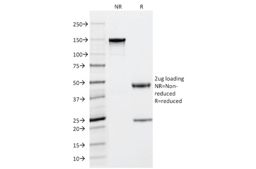 SDS-PAGE - Anti-Mast Cell Tryptase Antibody [TPSAB1/1963] (A250207) - Antibodies.com