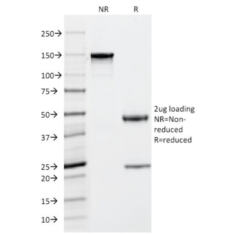 SDS-PAGE - Anti-Mast Cell Tryptase Antibody [TPSAB1/1963] (A250207) - Antibodies.com