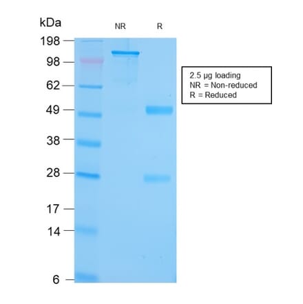 SDS-PAGE - Anti-GRP94 Antibody [HSP90B1/3168R] (A250208) - Antibodies.com