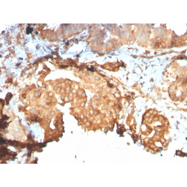 Immunohistochemistry - Anti-GRP94 Antibody [HSP90B1/3168R] (A250208) - Antibodies.com