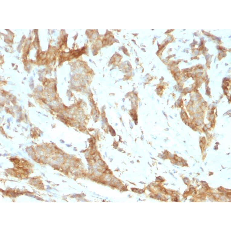 Immunohistochemistry - Anti-GRP94 Antibody [SPM249] (A250210) - Antibodies.com
