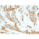 Immunohistochemistry - Anti-GRP94 Antibody [SPM249] (A250210) - Antibodies.com
