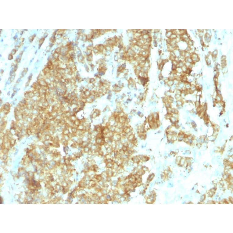 Immunohistochemistry - Anti-GRP94 Antibody [HSP90B1/1192] (A250210) - Antibodies.com