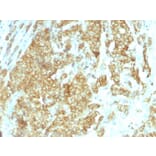 Immunohistochemistry - Anti-GRP94 Antibody [HSP90B1/1192] (A250210) - Antibodies.com