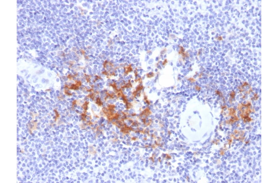 Immunohistochemistry - Anti-TRAF1 Antibody [TRAF1/2770] (A250212) - Antibodies.com