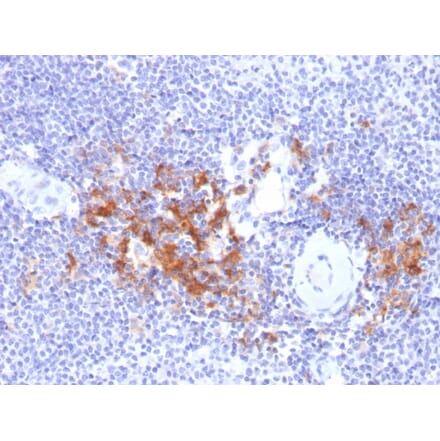 Immunohistochemistry - Anti-TRAF1 Antibody [TRAF1/2770] (A250212) - Antibodies.com