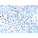 Immunohistochemistry - Anti-TRAF1 Antibody [TRAF1/2770] (A250212) - Antibodies.com