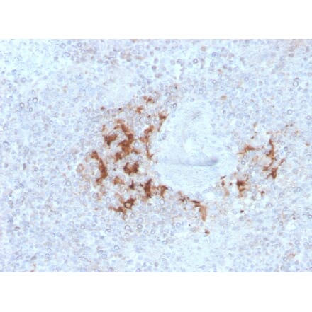 Immunohistochemistry - Anti-TRAF1 Antibody [TRAF1/3298] (A250213) - Antibodies.com