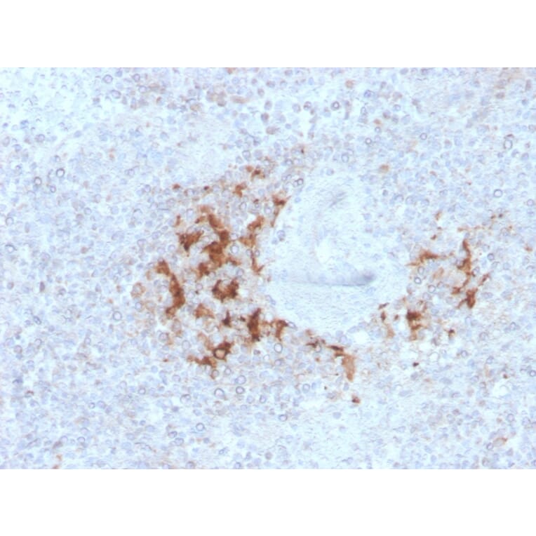 Immunohistochemistry - Anti-TRAF1 Antibody [TRAF1/3298] (A250213) - Antibodies.com
