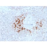 Immunohistochemistry - Anti-TRAF1 Antibody [TRAF1/3298] (A250213) - Antibodies.com