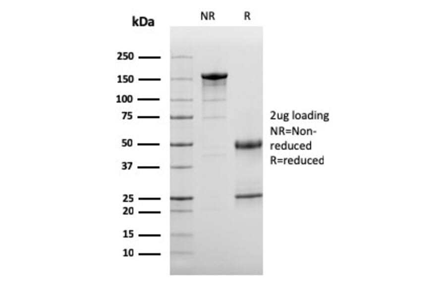 SDS-PAGE - Anti-C3d Antibody [C3D/2891] (A250214) - Antibodies.com
