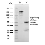 SDS-PAGE - Anti-C3d Antibody [C3D/2891] (A250214) - Antibodies.com