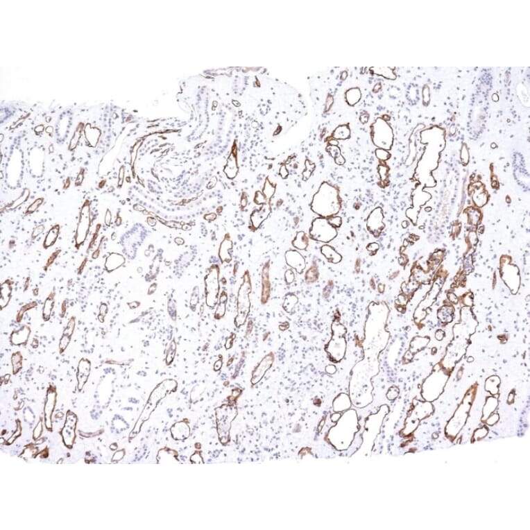 Immunohistochemistry - Anti-C4d Antibody [C4D204] (A250215) - Antibodies.com