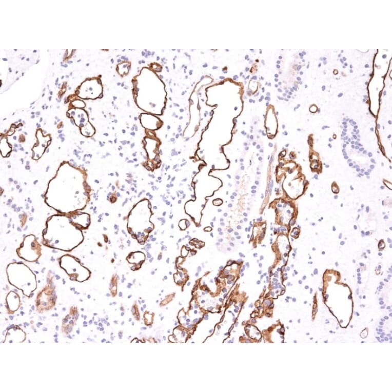 Immunohistochemistry - Anti-C4d Antibody [C4D204] (A250215) - Antibodies.com