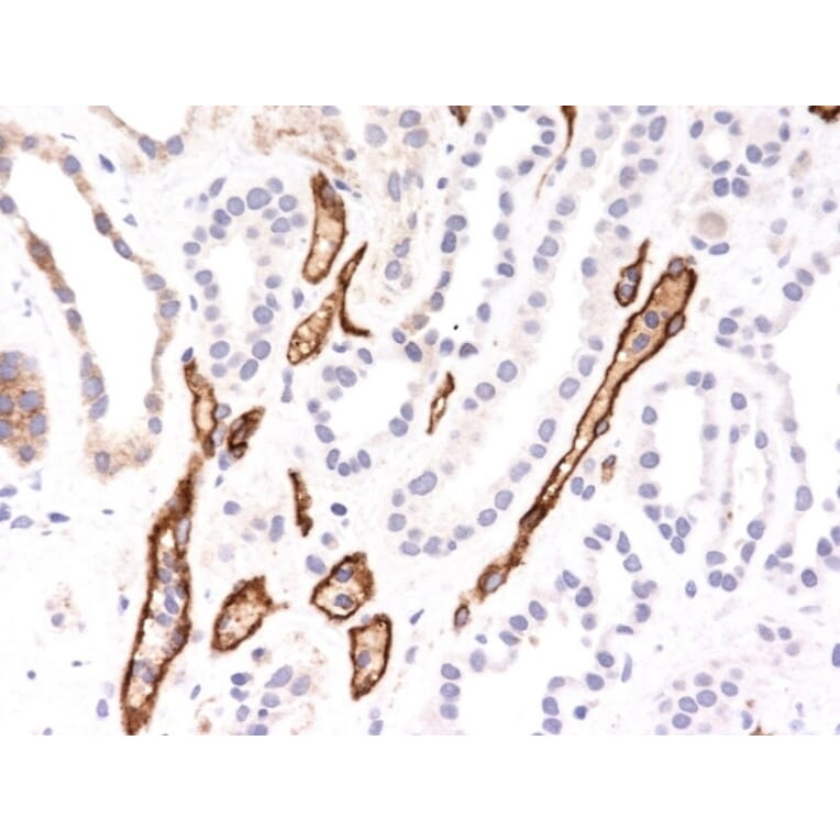 Immunohistochemistry - Anti-C4d Antibody [SPM545] (A250215) - Antibodies.com