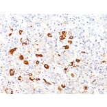 Immunohistochemistry - Anti-TSH beta Antibody [TSHb/1317] (A250216) - Antibodies.com