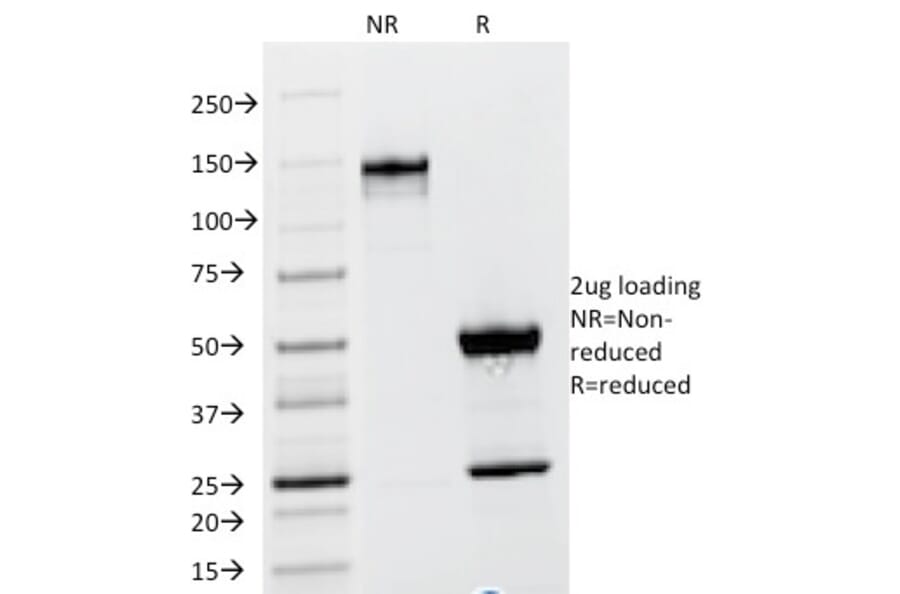 SDS-PAGE - Anti-TSH beta Antibody [TSHb/1317] (A250217) - Antibodies.com