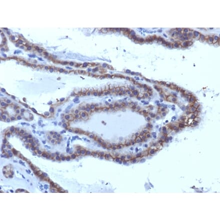 Immunohistochemistry - Anti-TSH Receptor Antibody [SPM223] (A250217) - Antibodies.com