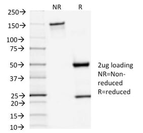 SDS-PAGE - Anti-TSH Receptor Antibody [TSHRA/1402] (A250219) - Antibodies.com