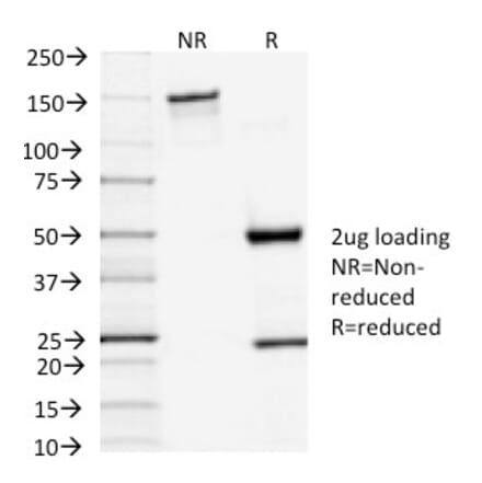 SDS-PAGE - Anti-TSH Receptor Antibody [TSHRA/1402] (A250219) - Antibodies.com