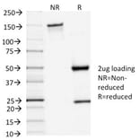 SDS-PAGE - Anti-TSH Receptor Antibody [TSHRA/1402] (A250219) - Antibodies.com