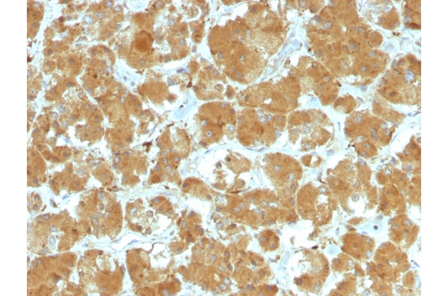 Immunohistochemistry - Anti-TSH Receptor Antibody [TSHRA/1402] (A250218) - Antibodies.com