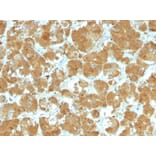 Immunohistochemistry - Anti-TSH Receptor Antibody [TSHRA/1402] (A250218) - Antibodies.com