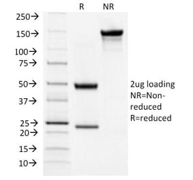 SDS-PAGE - Anti-TSH Receptor Antibody [TSHRB/1404] (A250219) - Antibodies.com