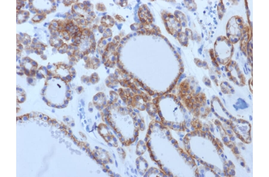 Immunohistochemistry - Anti-TSH Receptor Antibody [TSHRB/1405] (A250220) - Antibodies.com
