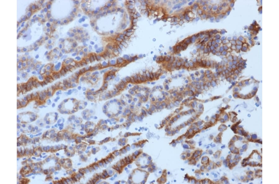 Immunohistochemistry - Anti-TSH Receptor Antibody [SPM222] (A250221) - Antibodies.com